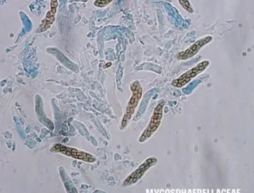US CBP protects U.S. agriculture with first-in-nation pathogen interception at George Bush Intercontinental Airport